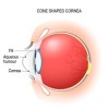 Cornea